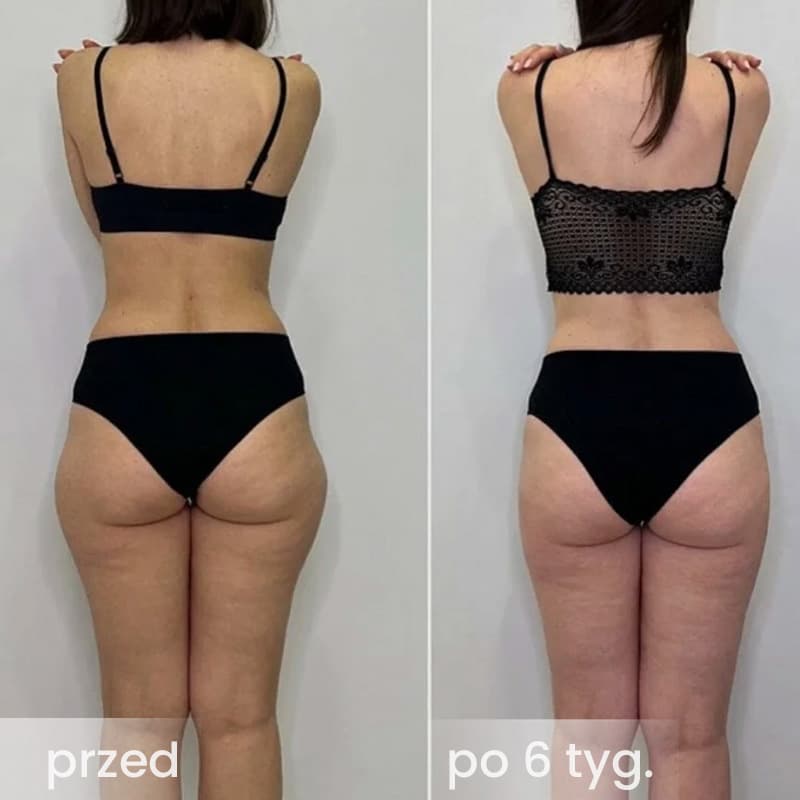 SlimRoll - modelująco-masujący roller